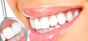 Teeth Whitening | Walden Family Dental